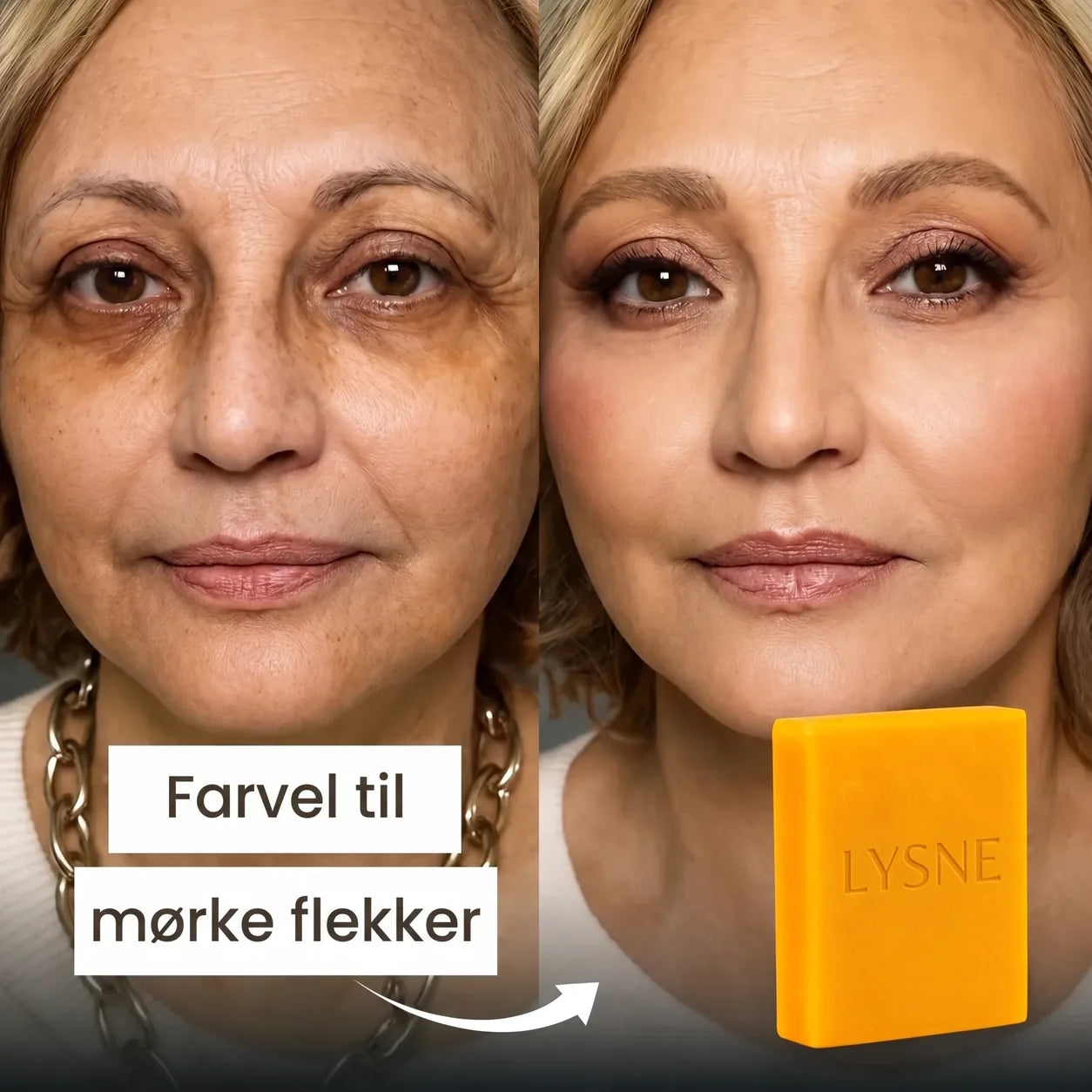 Farvel til mørke flekker