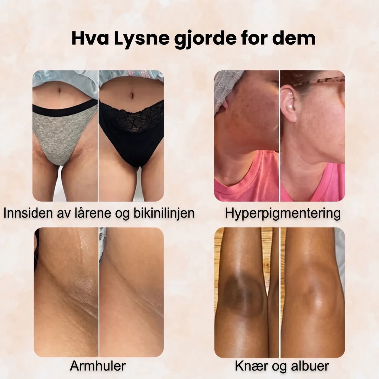 Hva Lysne gjorde for dem